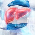 中国研究人员利用微泡缩小侵袭性肝肿瘤：论文