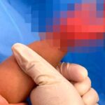 Domestic helper arrested after 1-year-old girl suffers burns in Hong Kong